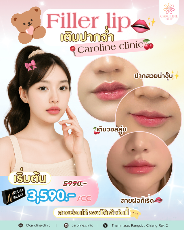 ชื่อโปรโมชันที่ 2