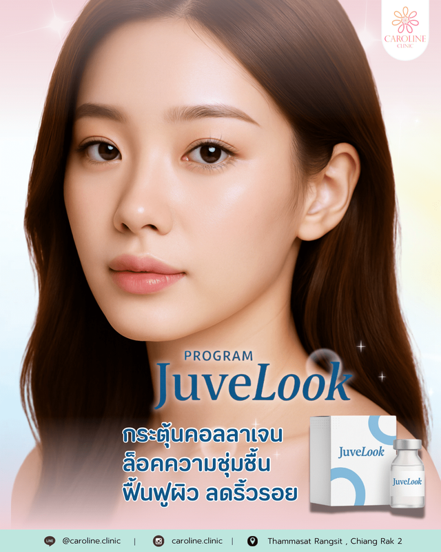 ชื่อโปรโมชันที่ 3