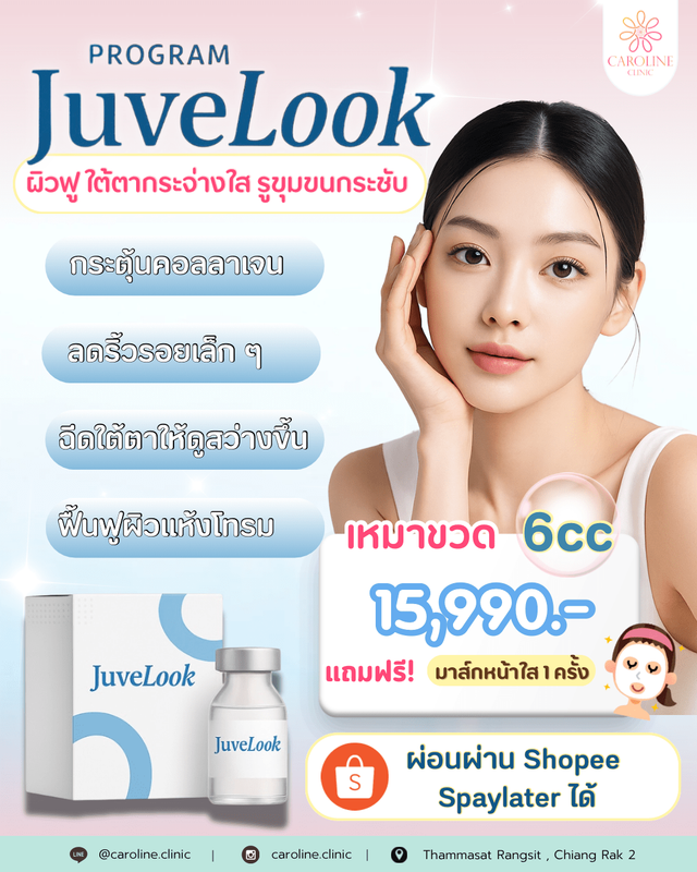 ชื่อโปรโมชันที่ 4